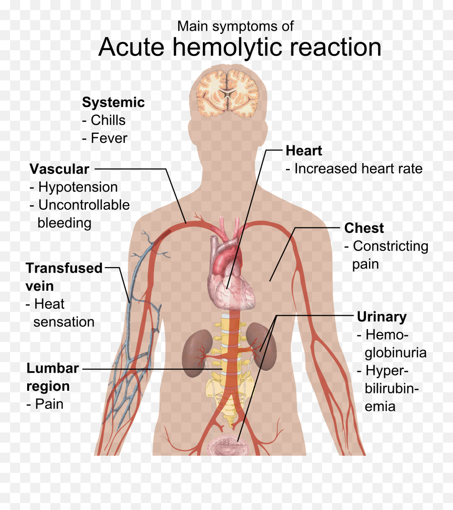 Main Symptoms Of Acute Hemolytic Reaction - Effect Of Hypothyroidism Emoji,Shoulder Shrug Emoji