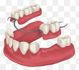 Dental Blog - Denture Cost In Taiwan Emoji,Missing Tooth Emoji