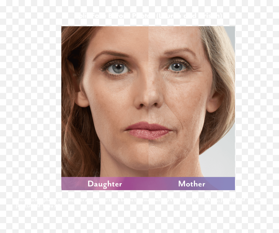 Juvederm Xc - Snooty Antiaging U0026 Wellness Screenshot Emoji,Botox Emoji