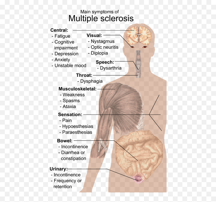 Symptoms Of Multiple Sclerosis - Esclerosis Multiple Del Sistema Nervioso Emoji,Shoulder Shrug Emoji