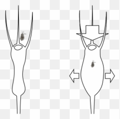 Utricularia Trap Expansion - Utricularia Emoji,Trap Emoji