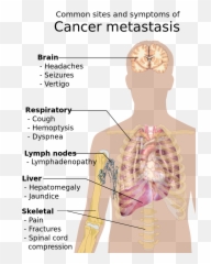 Symptoms Of Cancer Metastasis - Common Sites And Symptoms Of Cancer Metastasis Emoji,Shoulder Shrug Emoji