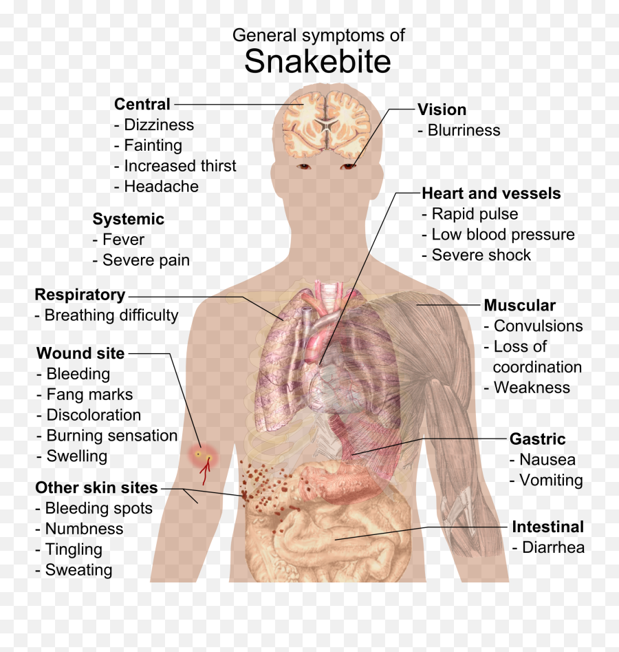 Snake Bite Symptoms - Infectious Mononucleosis Symptoms Emoji,Snake Emoji