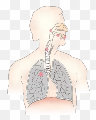 Cancer Carcinoma Metastases Airway - Clipart Transparent Background Photo Of Lungs Emoji,Muscle Emoticon
