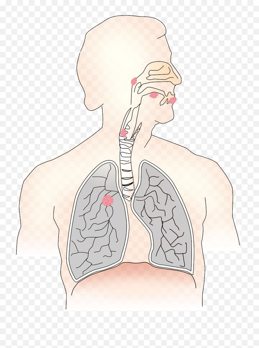 Cancer Carcinoma Metastases Airway - Clipart Transparent Background Photo Of Lungs Emoji,Muscle Emoticon