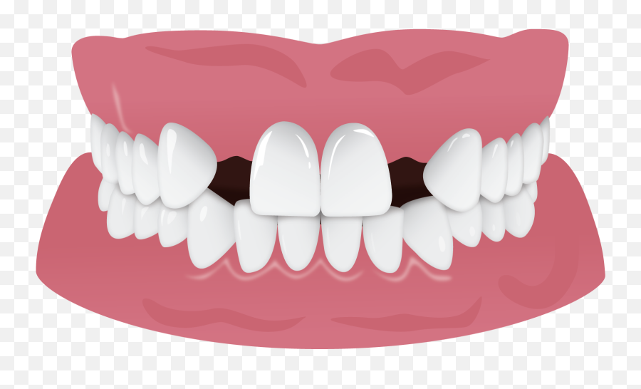 Teeth Smile Png - Missing Teeth Emoji,Missing Teeth Emoji