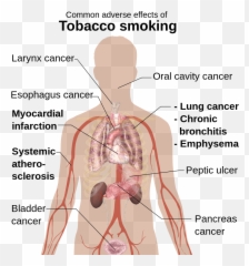 Adverse Effects Of Tobacco Smoking - Common Adverse Effects Of Tobacco Smoking Emoji,Shoulder Shrug Emoji