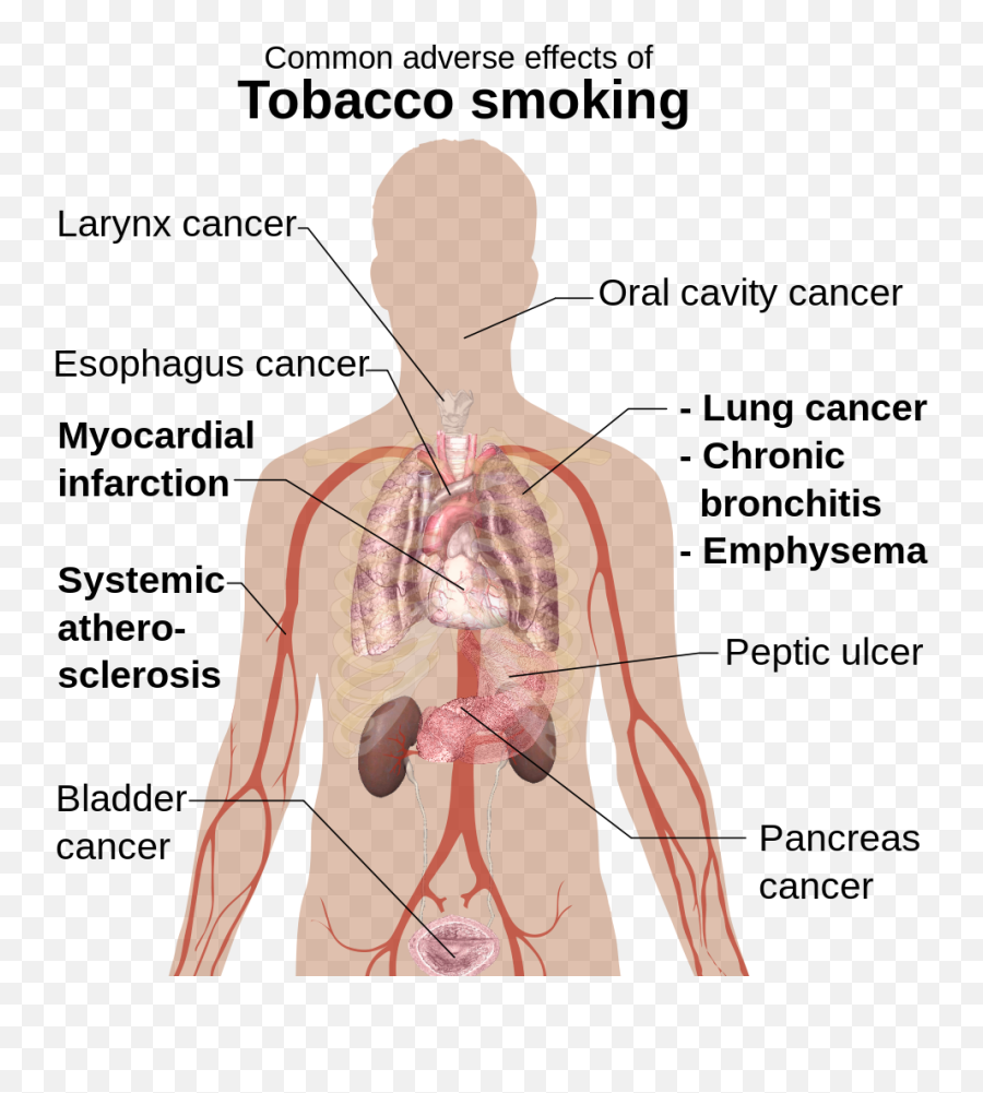 Adverse Effects Of Tobacco Smoking - Common Adverse Effects Of Tobacco Smoking Emoji,Shoulder Shrug Emoji