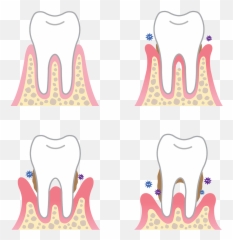 Tooth Gap Clipart - Dental Periodontal Emoji,Gap Tooth Emoji