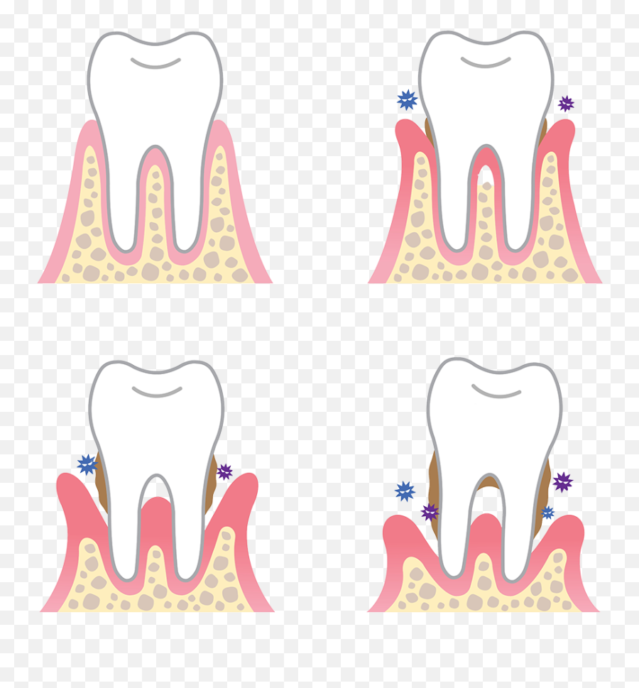 Tooth Gap Clipart - Dental Periodontal Emoji,Gap Tooth Emoji