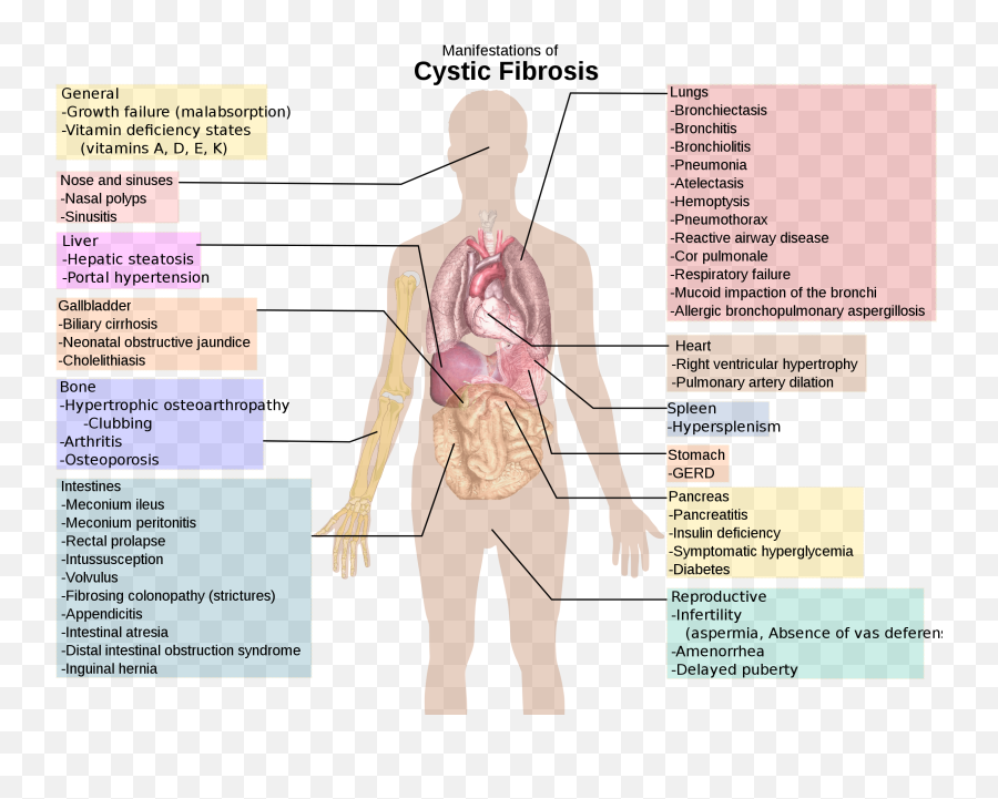 Cystic Fibrosis Manifestations - Cystic Fibrosis Symptoms Emoji,Emotional Emoji