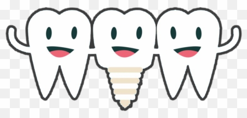 Dental Implants Burlington - Tooth Emoji,Tooth Emoticon