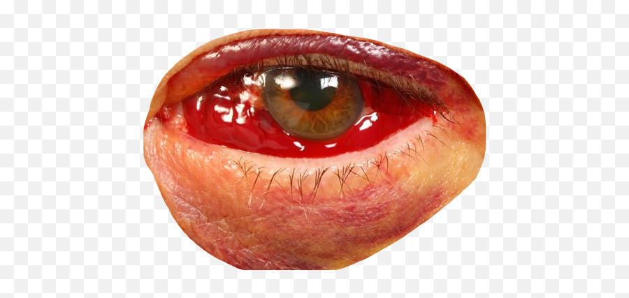 Eye Bloodshot Blood Redeye - Red Bloodshot Eyes Png Emoji,Bloodshot Eyes Emoji