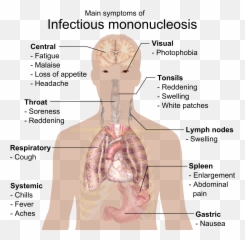 Main Symptoms Of Infectious Mononucleosis - Emoji