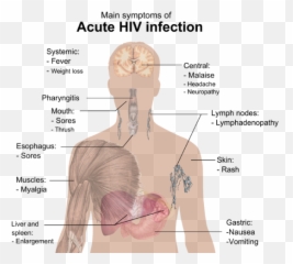 Symptoms Of Acute Hiv Infection - Hiv Symptoms Emoji,Shoulder Shrug Emoji
