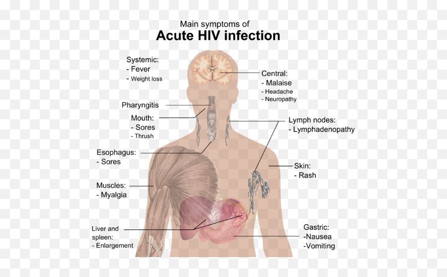 Symptoms Of Acute Hiv Infection - Hiv Symptoms Emoji,Shoulder Shrug Emoji