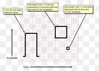 Electrocardiography - Ecg Graph Paper Emoji,Rectangle With X Inside Emoji