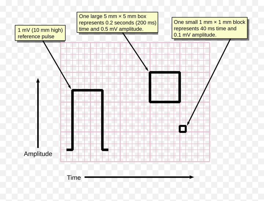 Electrocardiography - Ecg Graph Paper Emoji,Rectangle With X Inside Emoji