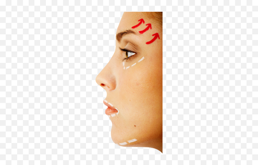 Face Surgery Nose Stock Photography Rhinoplasty - Woman Face Nose Sugary Png Emoji,Surgery Emoji