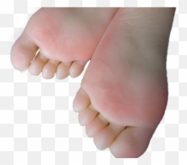 The Ginger - Barefoot Emoji,Emoji Toes