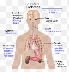 Main Symptoms Of Diabetes - Diabetes Type 1 Emoji,Shoulder Shrug Emoji