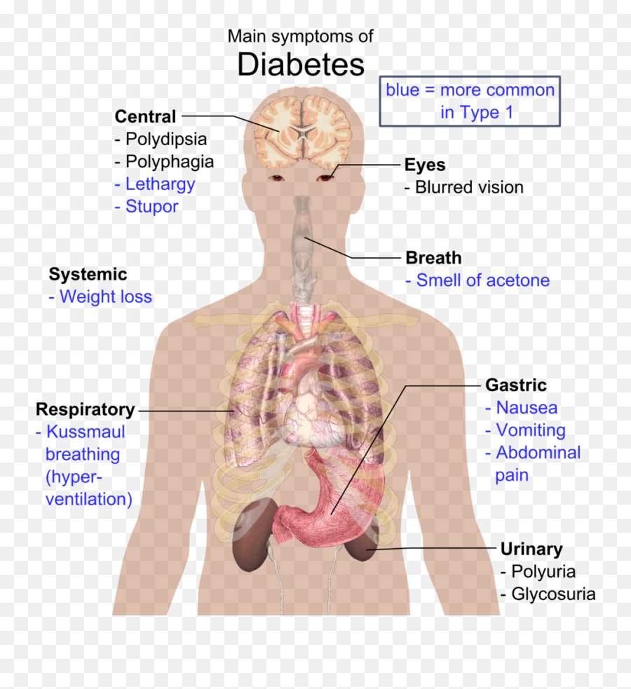 Main Symptoms Of Diabetes - Diabetes Type 1 Emoji,Shoulder Shrug Emoji