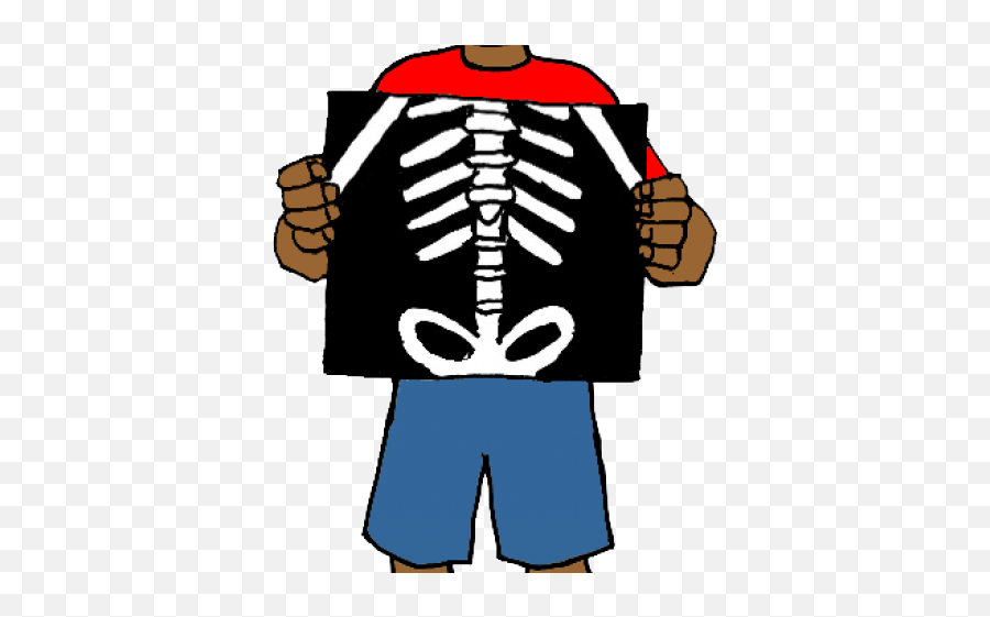 Clipart Picture Of X Ray - Clipart Of X Ray Emoji,X Ray Emoji