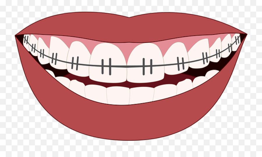 Clipart Smile Brace Transparent - Cartoon Mouth With Braces Emoji,Brace Face Emoji