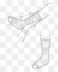 Vector Illustration Of Leg Cast Examination - Sketch Emoji
