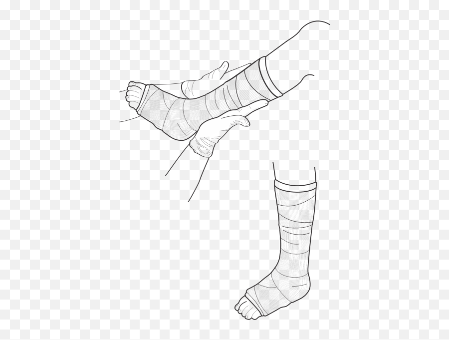 Vector Illustration Of Leg Cast Examination - Sketch Emoji,Rain Emoji