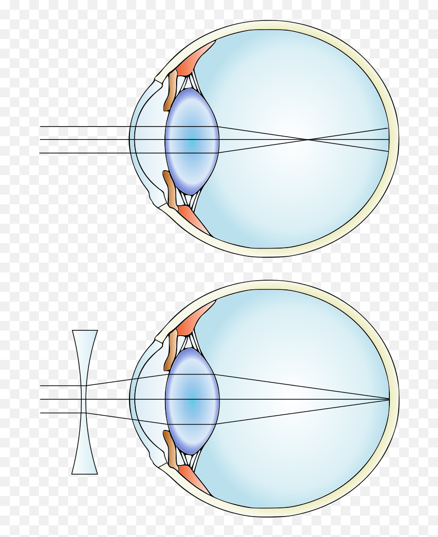 Myopia And Lens Correction - Myopia Mcat Emoji,Emotion Con