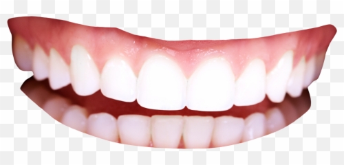 Best Braces Transparent Background - Teeth Png Emoji