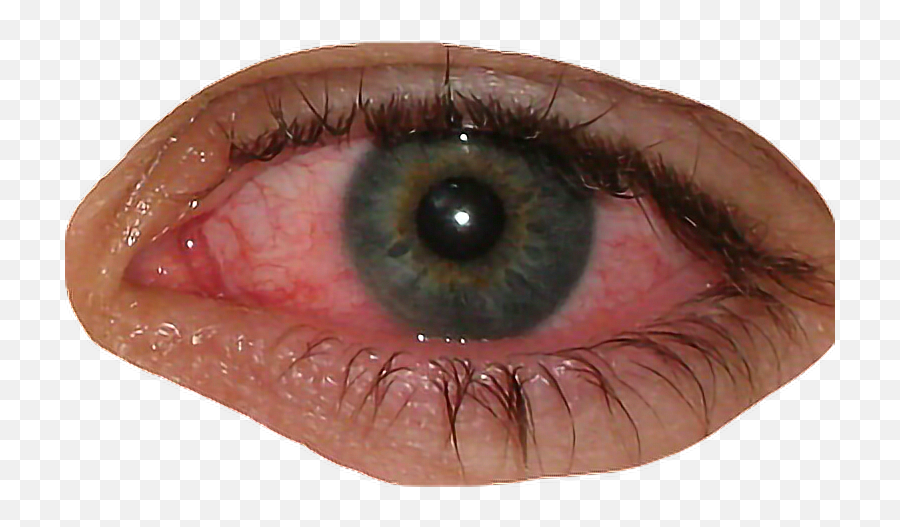 Eye Bloodshot Blood Redeye - Pink Eye Emoji,Bloodshot Eyes Emoji