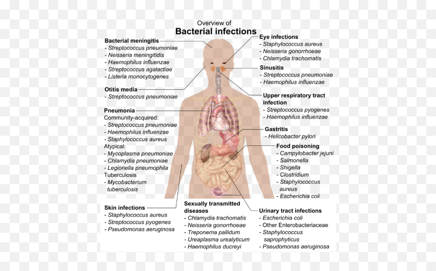 Bacterial Infections And Involved Species - Overview Of Bacterial Infections Emoji,Emoji Reviews