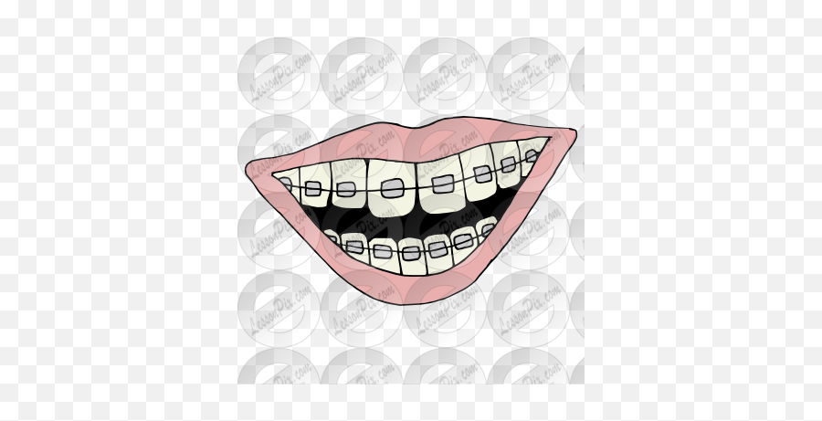 Emoji Clipart Png Picture - Dental Braces,Brace Face Emoji