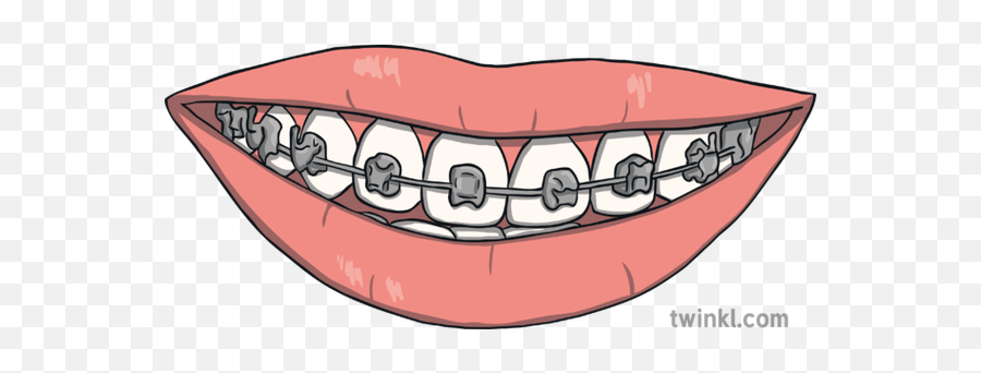 Braces Mouth Teeth Ks1 Illustration - Tongue Emoji,Braces Emoji