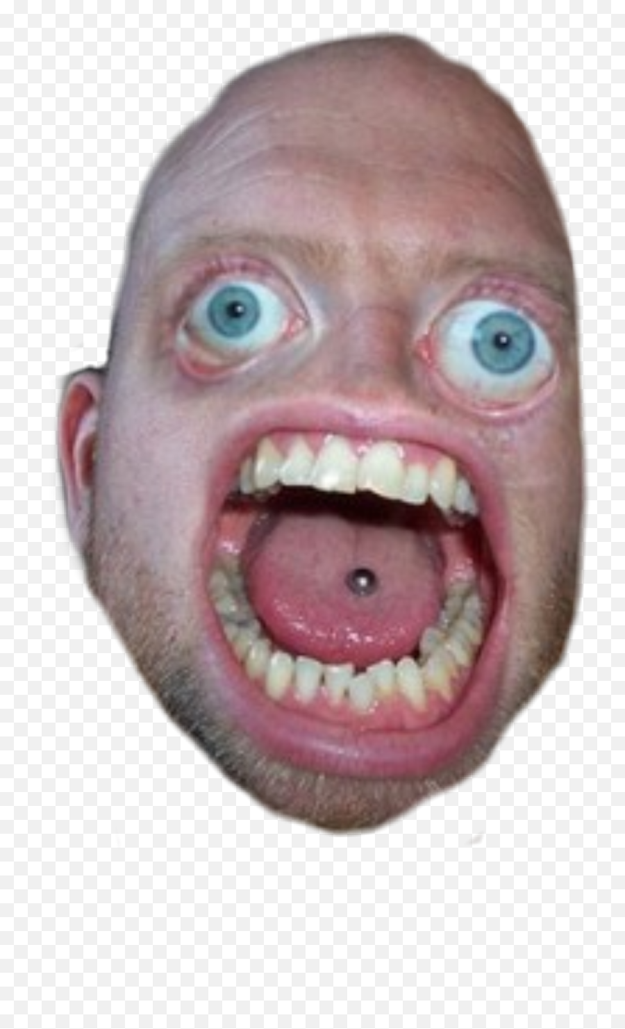 Bald Head Face Bigeyes Openmouth Odd Unique Guy Man Dud - Big Mouths Emoji,Bald Emoji