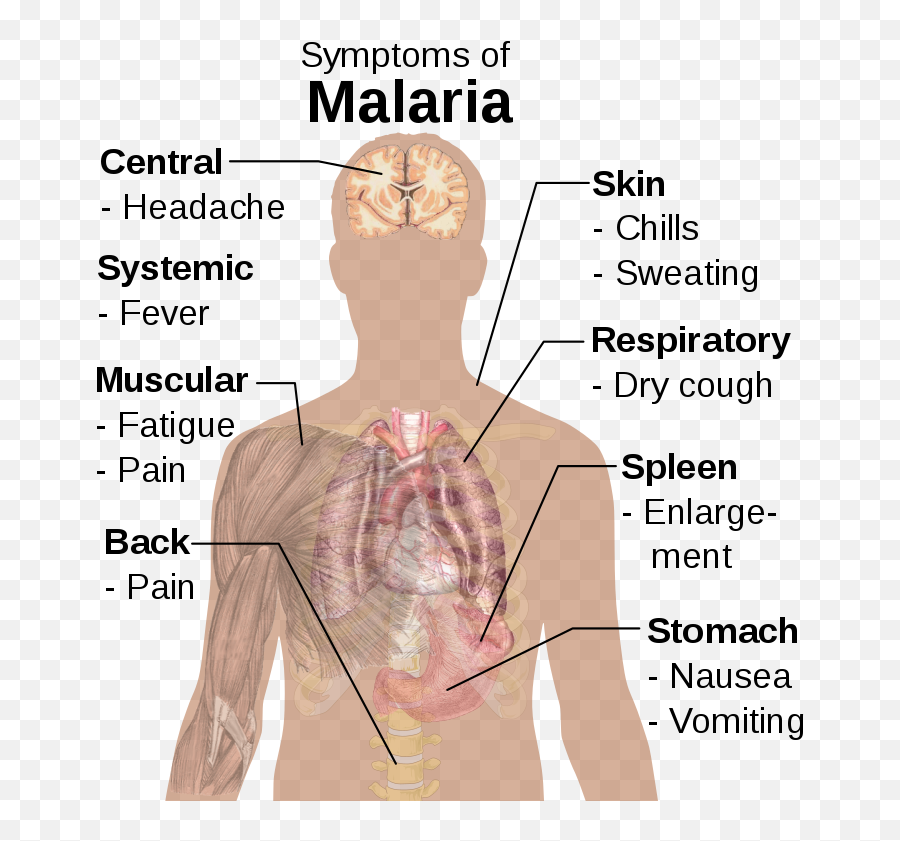 Symptoms Of Malaria - Parts Of The Body Affected By Malaria Emoji,Sleep Emoji Copy And Paste