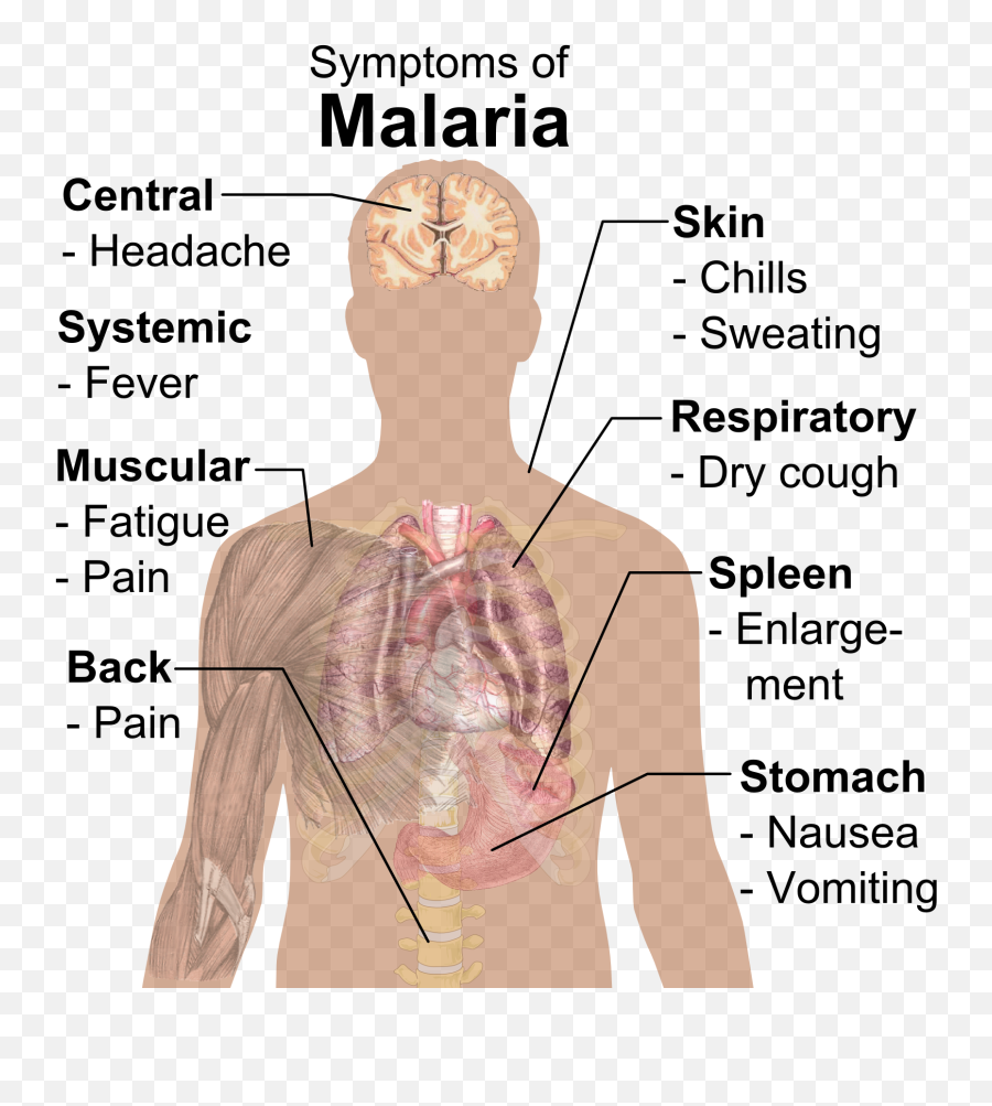 Symptoms Of Malaria - Parts Of The Body Affected By Malaria Emoji,Sweating Emoji