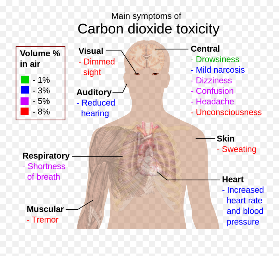 Main Symptoms Of Carbon Dioxide Toxicity - Carbon Dioxide Toxicity Emoji,Sweating Emoji